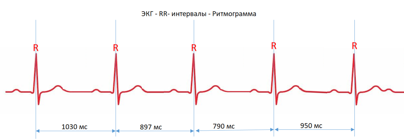 Интервал r r экг. Интервалы r-r на ЭКГ отражает. Норма r-r интервалов ЭКГ. Интервал RR на ЭКГ норма. Расшифровка ЭКГ интервал RR.